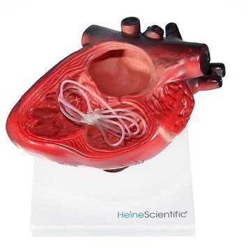 Canine Heart Anatomical Model with Parasite &ndash; detailed view | Veteq