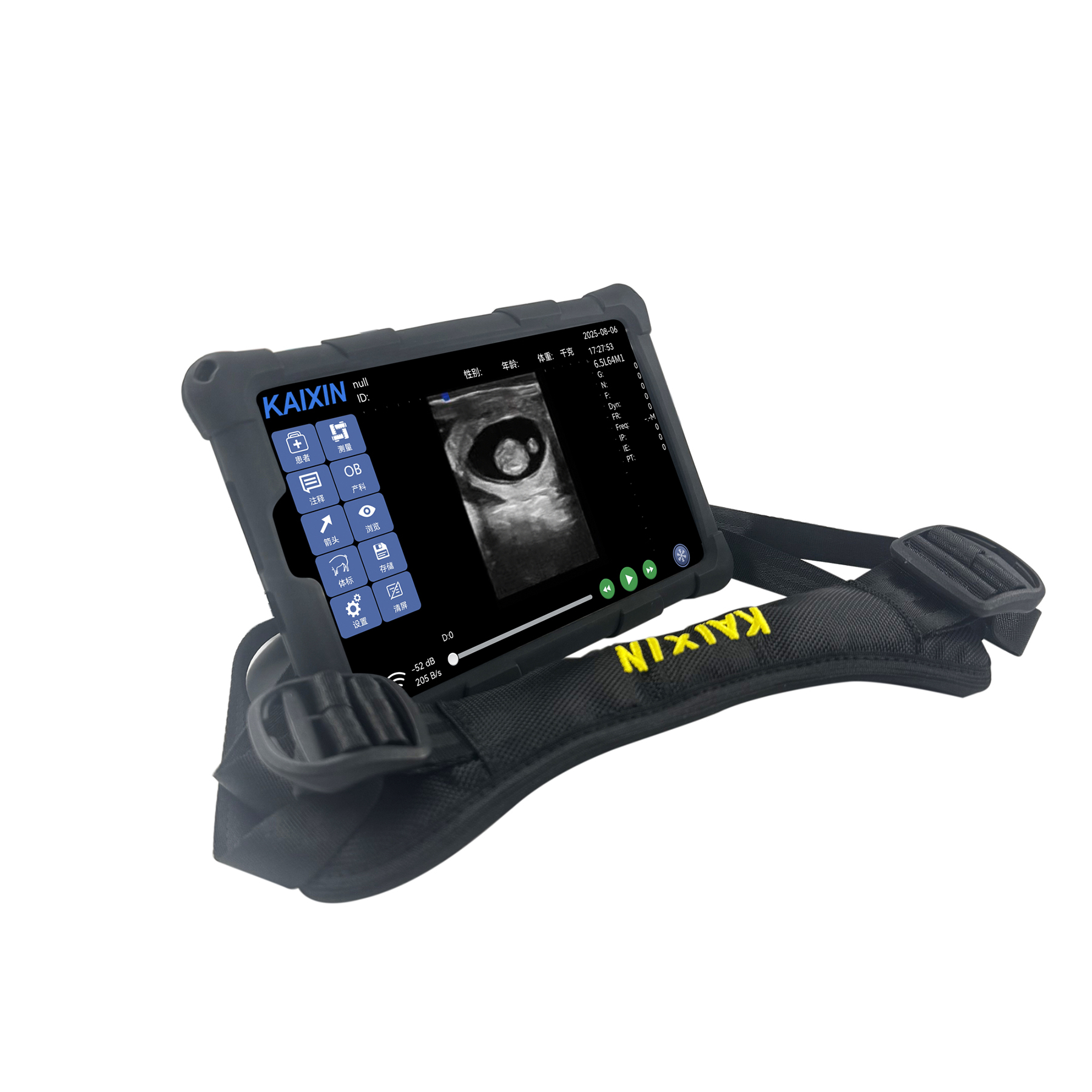 Kaixin K1 ultrasound