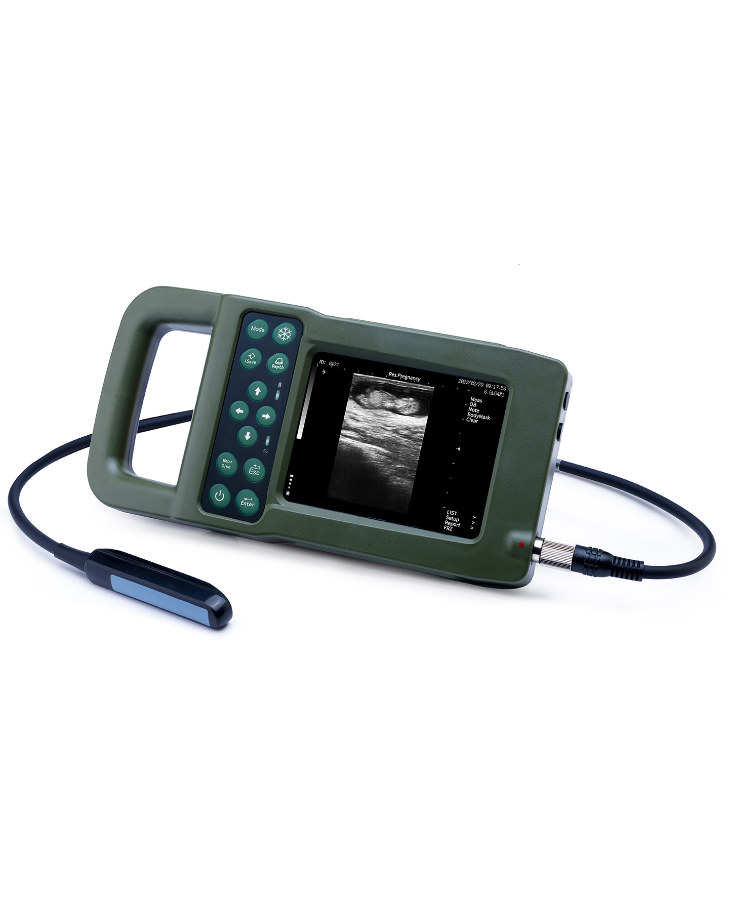 KX5600F ultrasound display